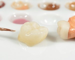 Porcelain dental crown being crafted