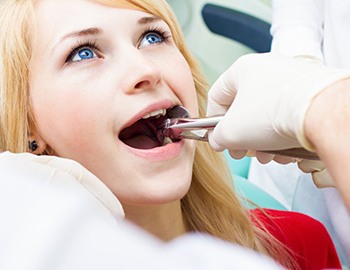 young woman getting tooth extraction in Milwaukee 