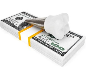 Model dental implant on top of a stack of money