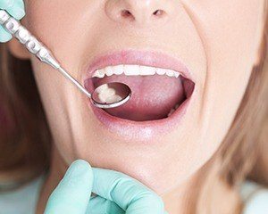 Closeup of smile during dental exam