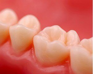 Closeup of flawlessly repaired teeth