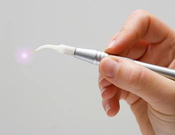 Hand holding a soft tissue laser tool