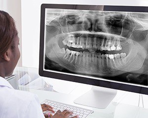 Panoramic dental x-rays on computer screen