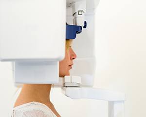 Woman receiving 3D cone beam scan