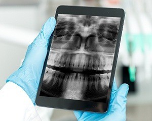 Panoramic dental x-rays on tablet computer