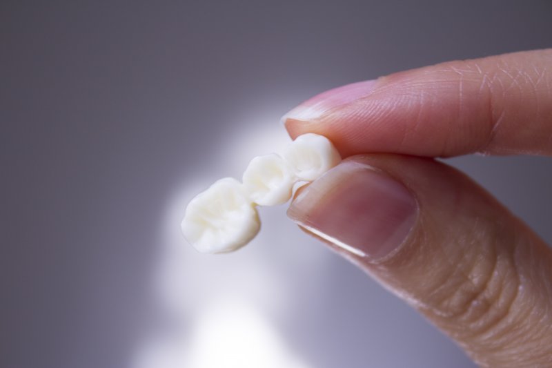 Close-up of a dental bridge