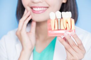 Dentist holding a model of a dental implant. 
