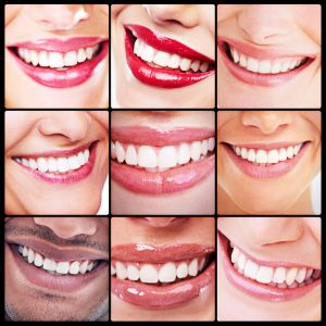 Teeth whitening in Milwaukee brightens dark dental stains. Dr. Barry Franzen uses in-office treatments for safe and reliable results.